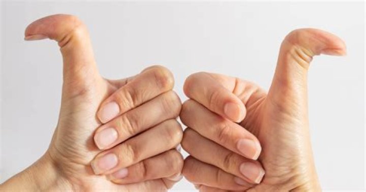 Freaky fingers! Am I double-jointed?