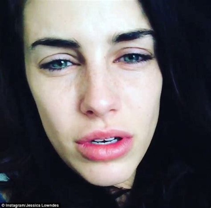 Jessica Lowndes Plastic Surgery Before and After